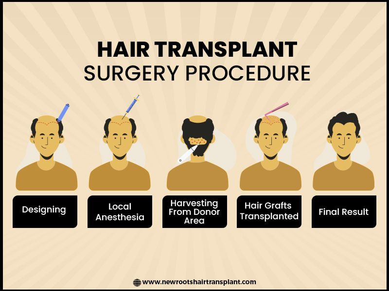 Hair Transplant Surgery Procedure