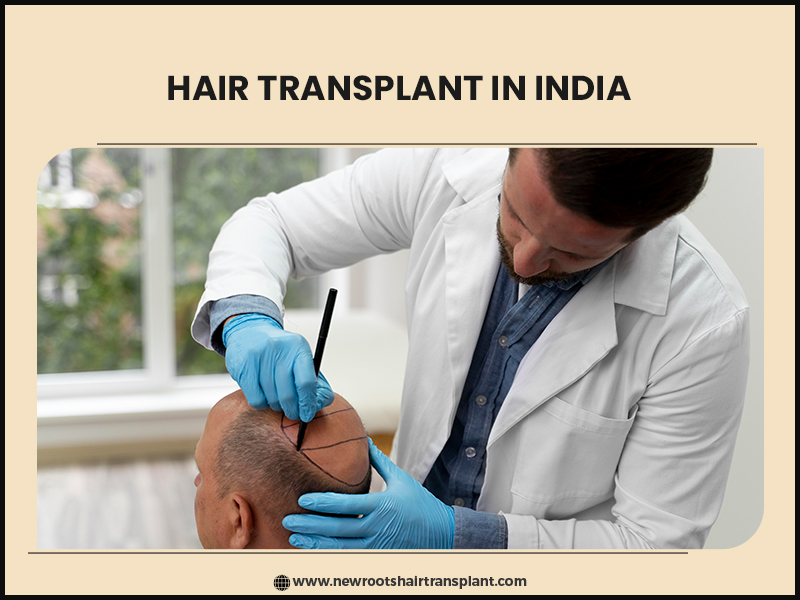 Hair Transplant in India