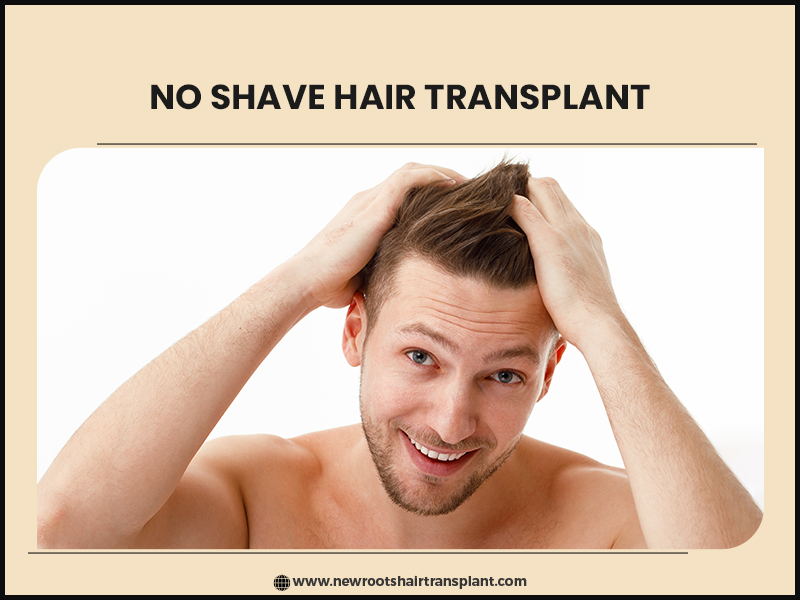 No Shave Hair Transplant