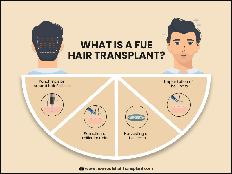 What is fue hair transplant