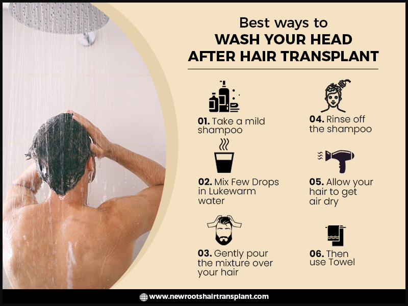 benefits of proper head wash after hair transplant