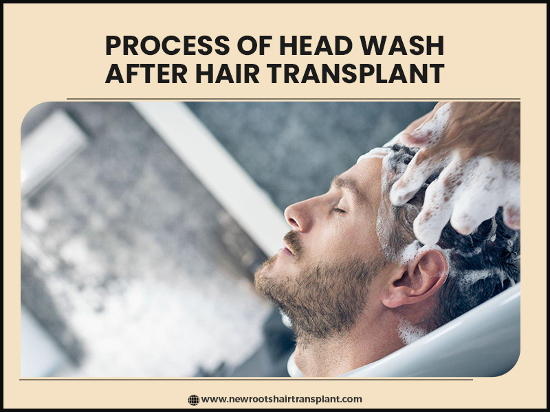 first head wash after hair transplant