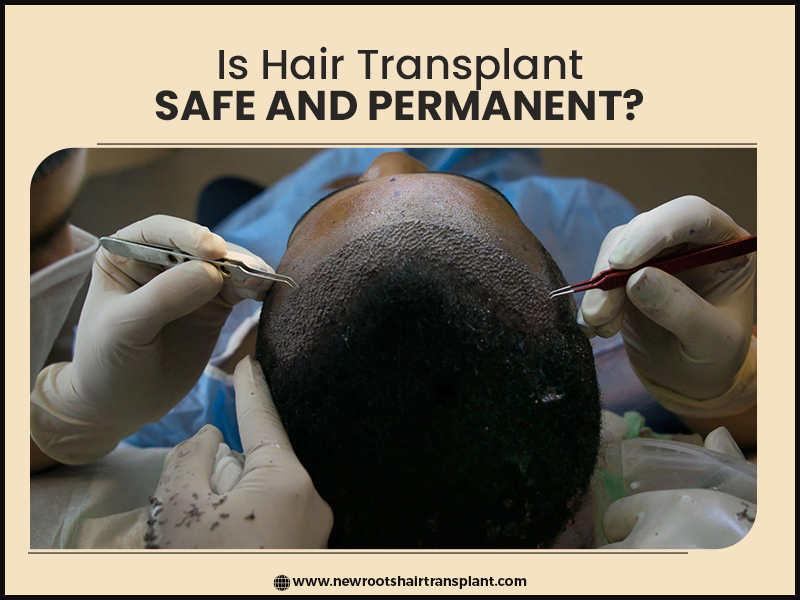 is hair transplant safe and permanent