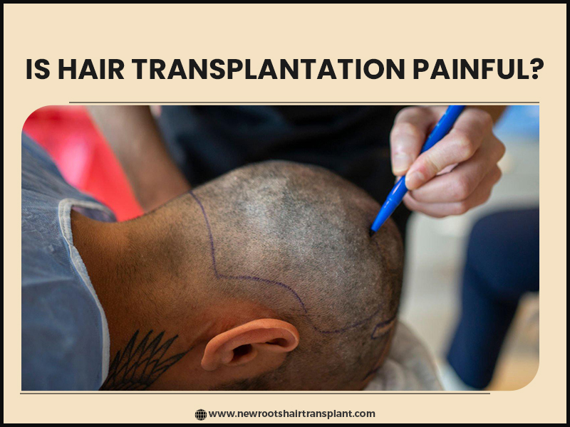 is hair transplantation painful