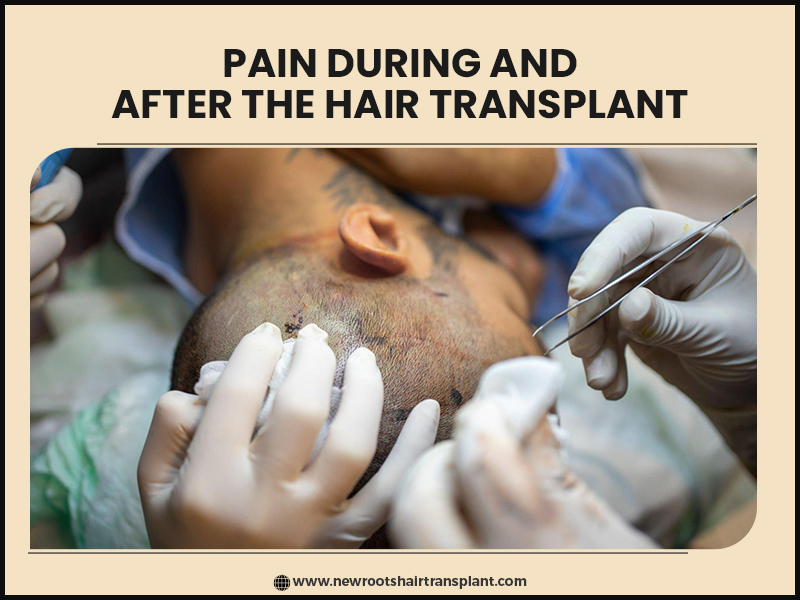 pain during and after the hair transplant