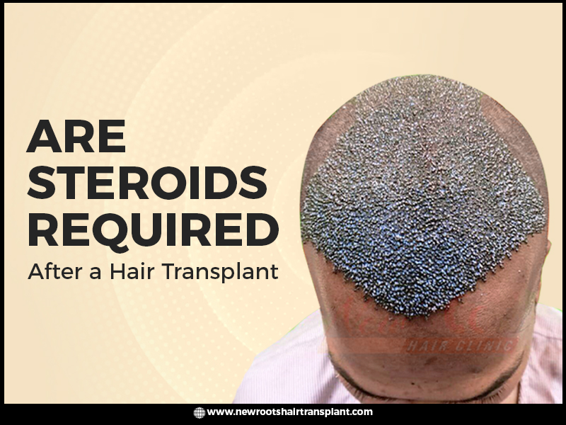 post hair transplant precautions