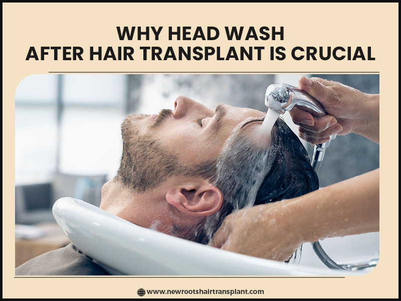 why head wash after hair transplant is crucial