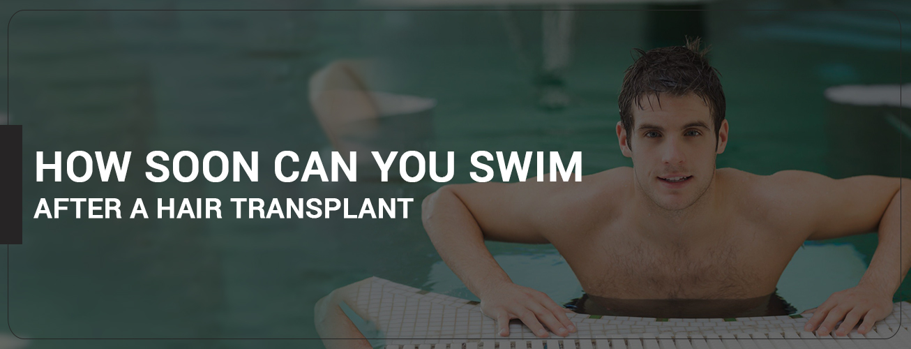 how-soon-can-you-swim-after-a-hair-transplant-5-tips-precautions