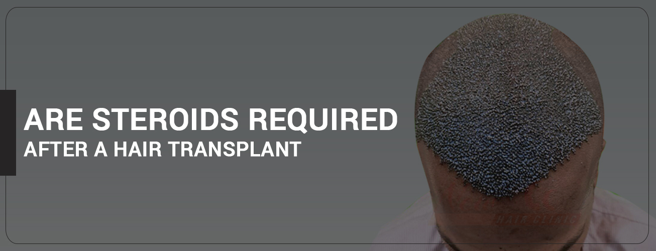 are steroids required after a hair transplant