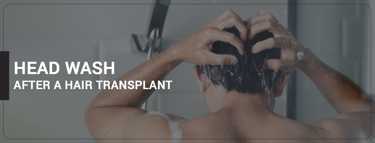 head wash after hair transplant