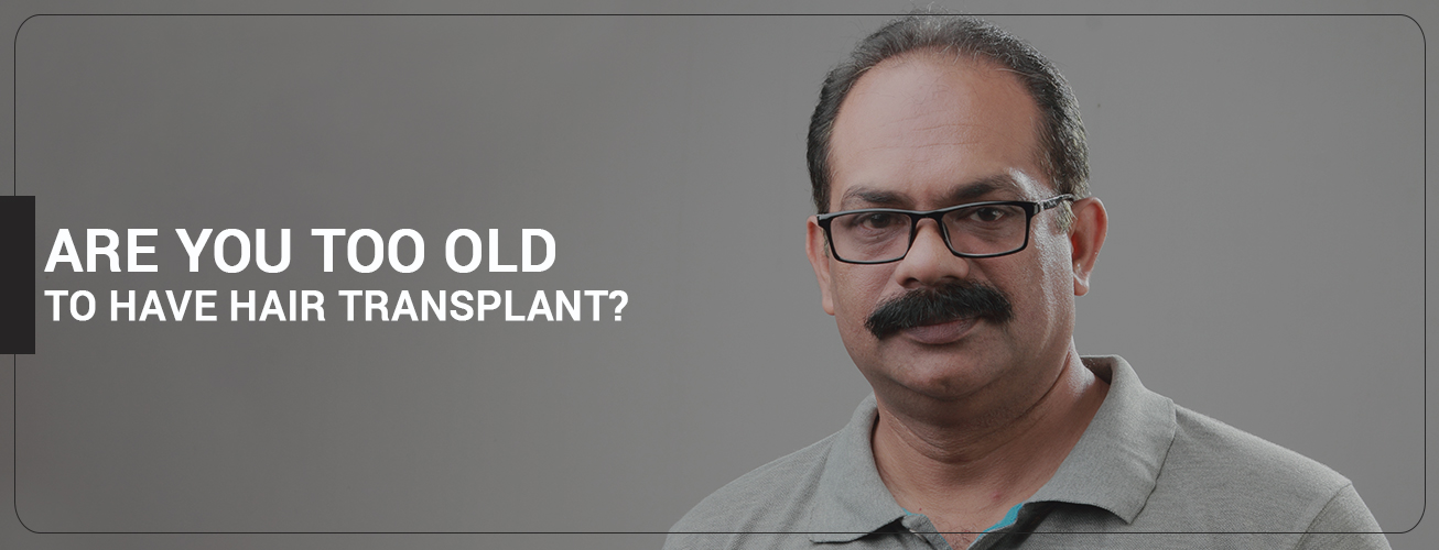 old age hair transplant